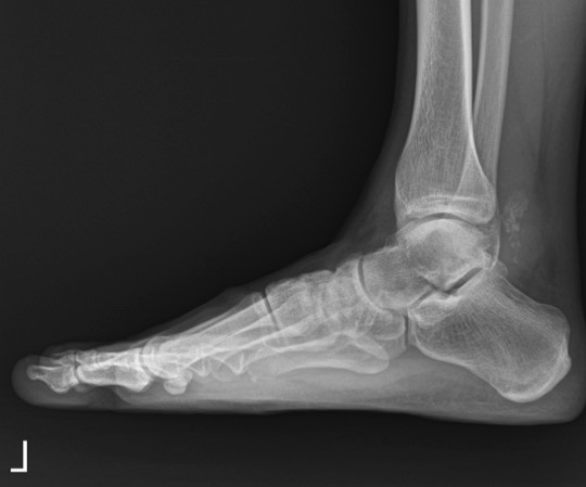 Figure 1 for case Chondroma ( RID4126 )